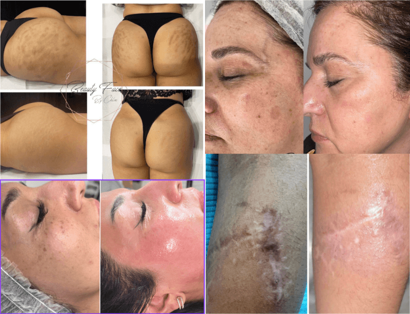 ZENA Algae Peeling 4-in-1 Konzept