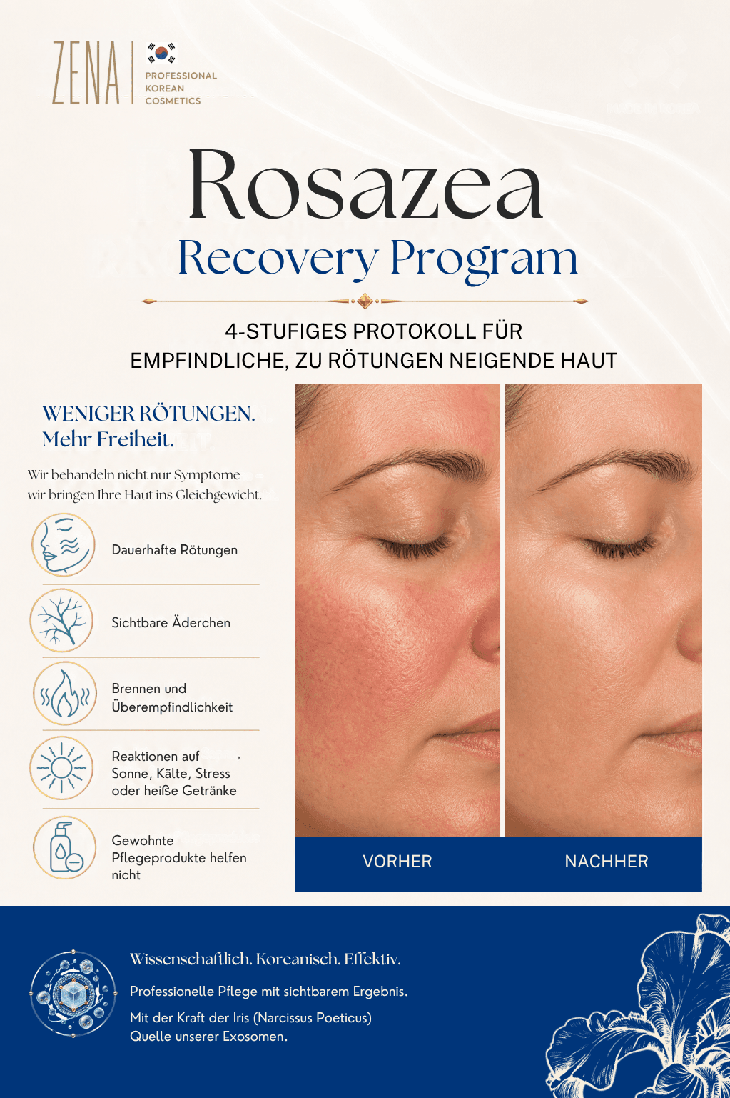 Broschüre Rosazea